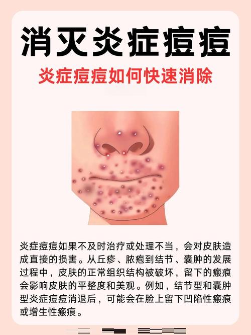 痘痘为什么会发炎