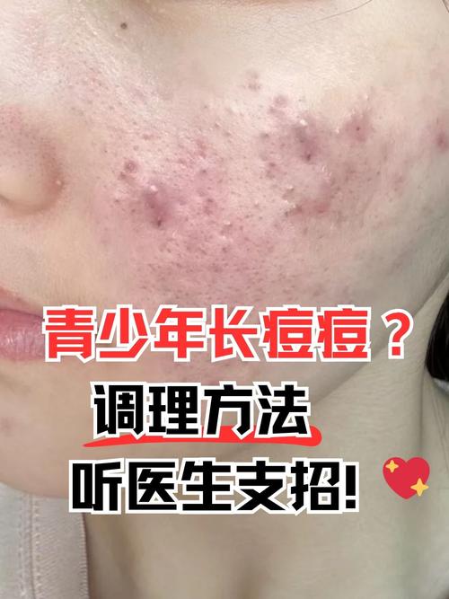 痘痘为什么会发炎
