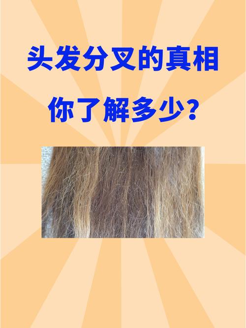 为什么头发容易分叉