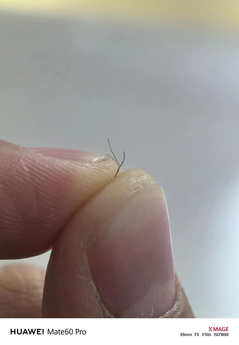 为什么头发容易分叉