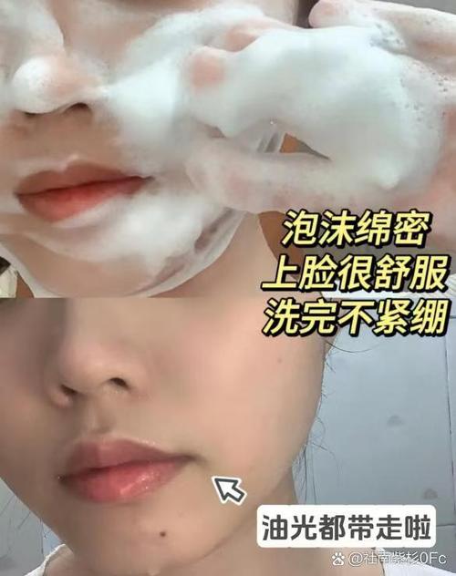 用完洗面奶不紧绷脱皮怎么回事