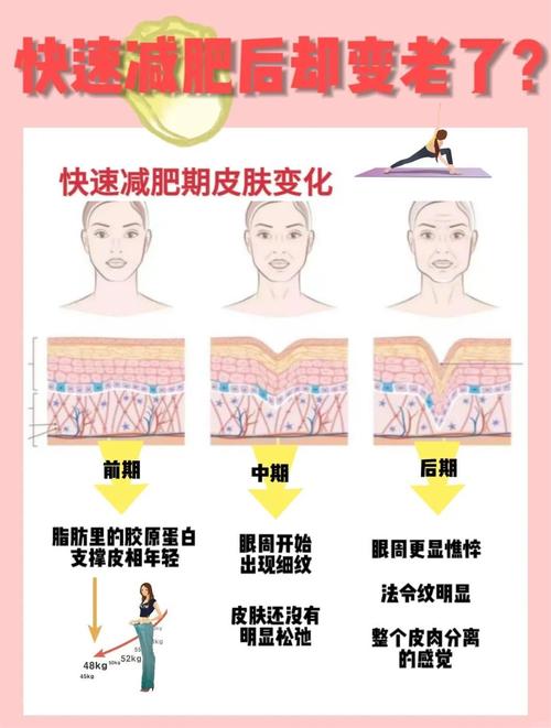 减肥后脸为什么松了怎么办