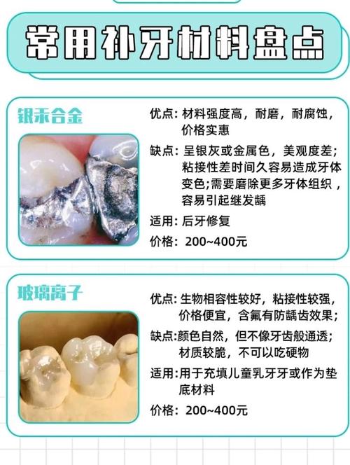 补牙都用什么材料