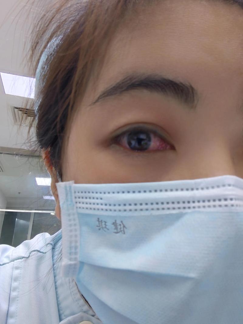 哭完为什么眼睛会肿