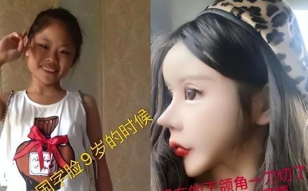 削骨有什么后遗症