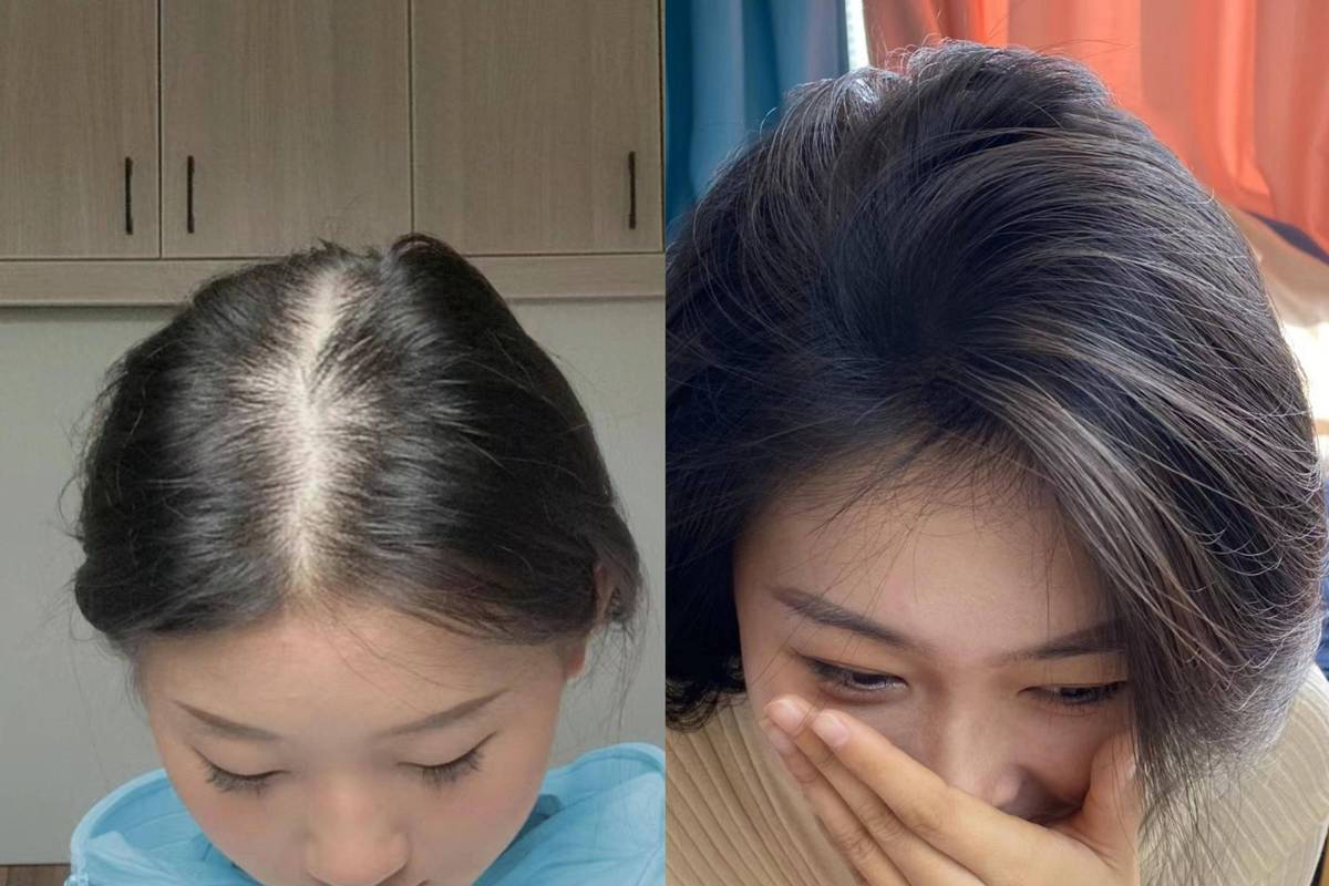 为什么头发越来越细