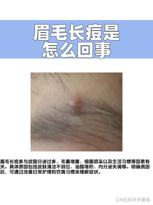 眉毛长长是什么征兆
