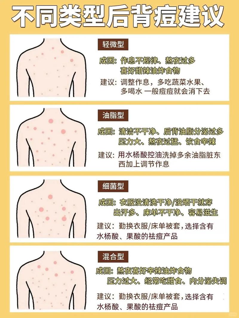 背上起疙瘩什么原因