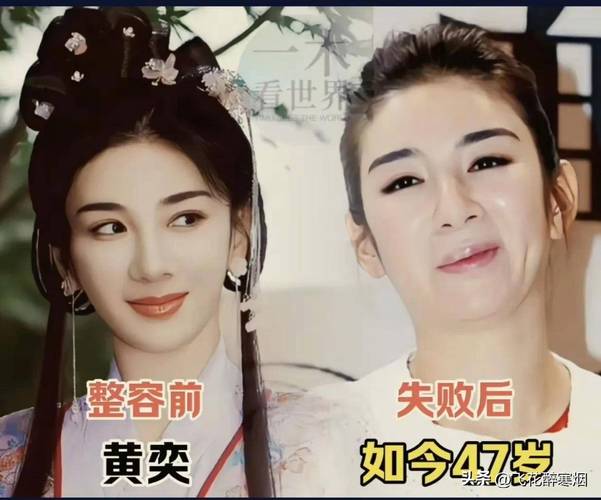 整容为什么会失败