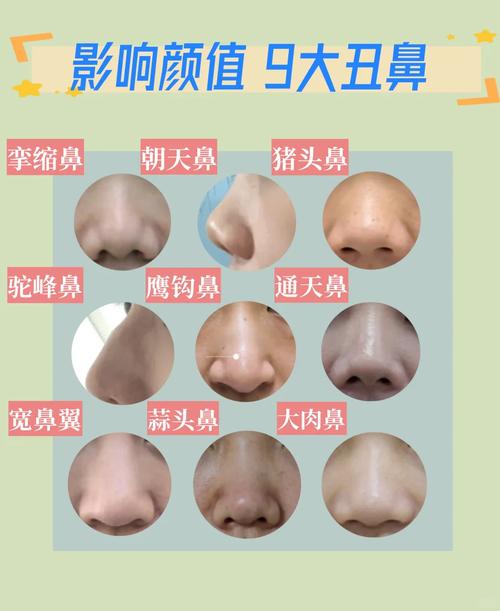 鼻子有什么类型