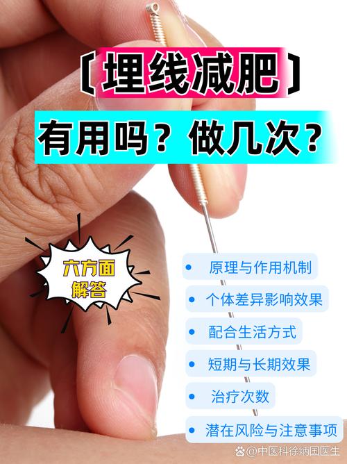 什么是埋线减肥法图片