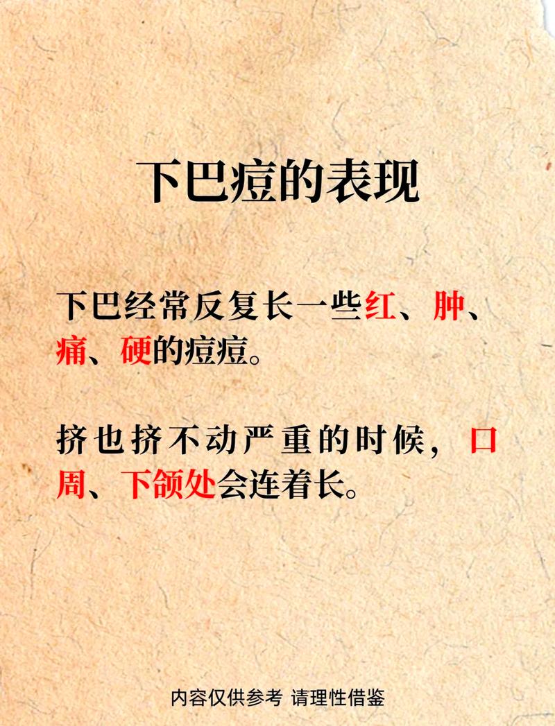 为什么下巴老长痘痘