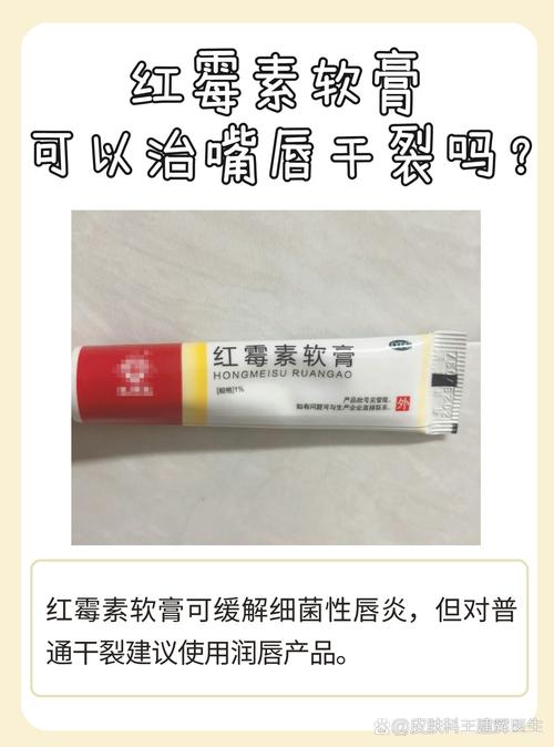 嘴唇干裂擦什么好