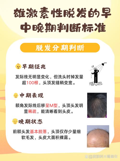 头发脱落是什么病