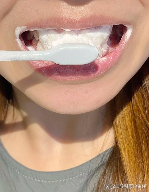 烤瓷牙不能吃什么