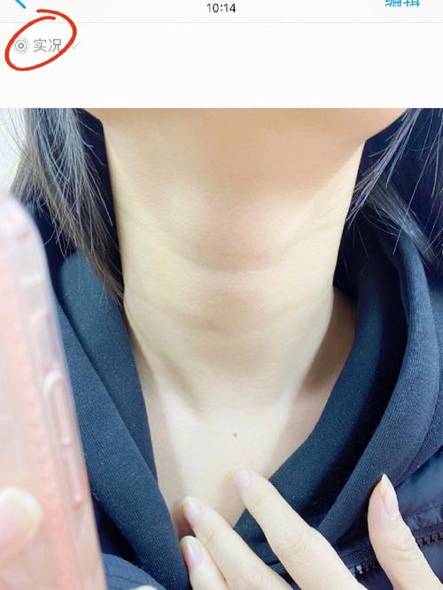 颈纹是什么样的