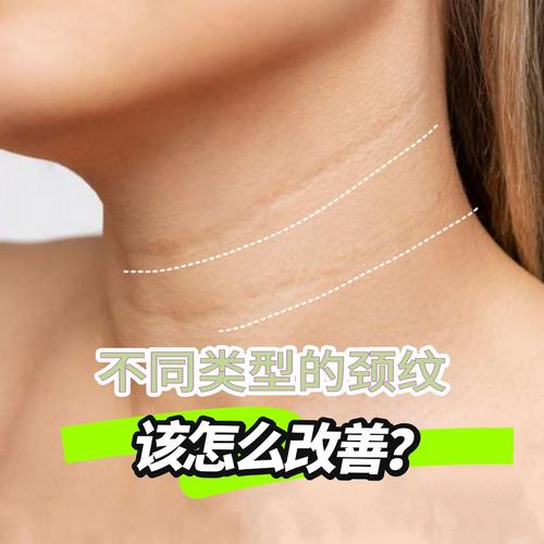 颈纹是什么样的