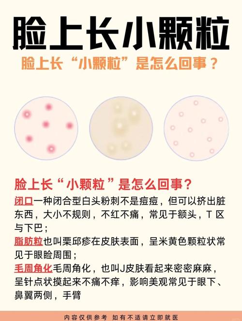 脑门起痘痘什么原因