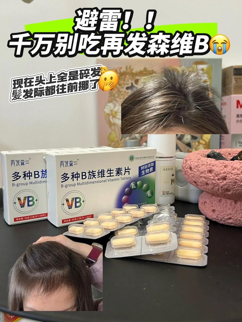 什么维生素治疗脱发