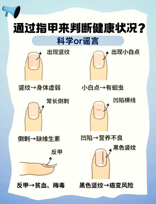 指甲为什么长竖纹