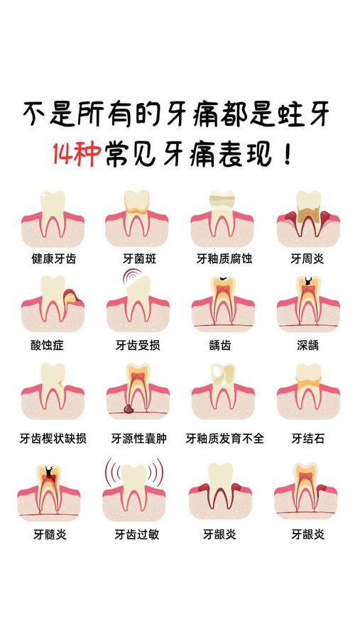 牙疼需要注意什么