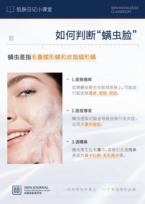 脸上为什么长螨虫