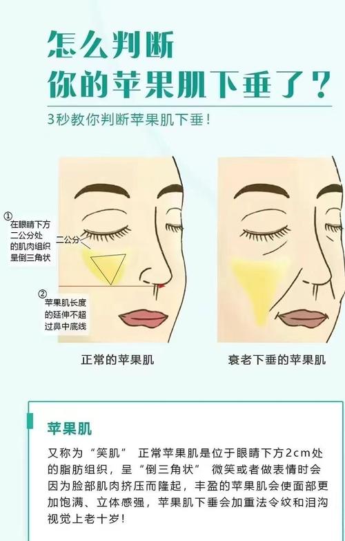 为什么没有苹果肌