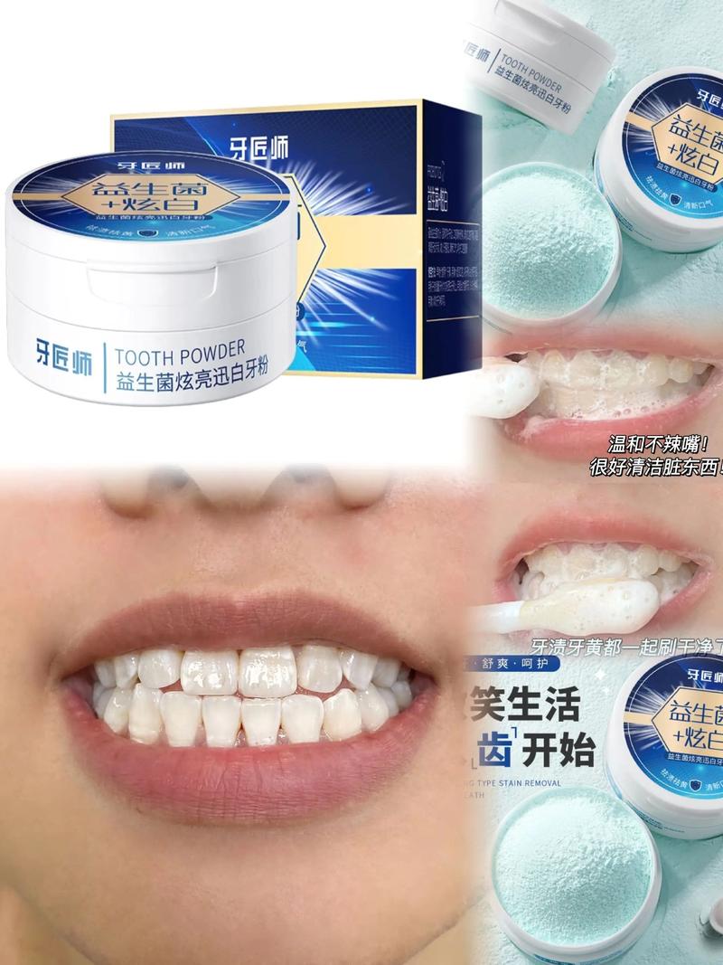 什么洗牙白