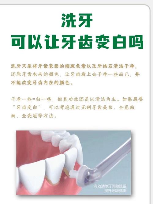 什么洗牙白