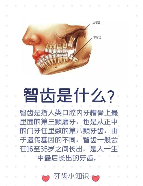 什么情况下长智齿