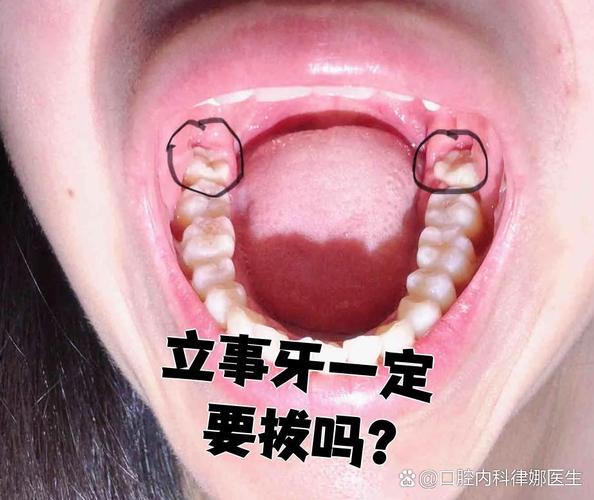 什么情况下长智齿