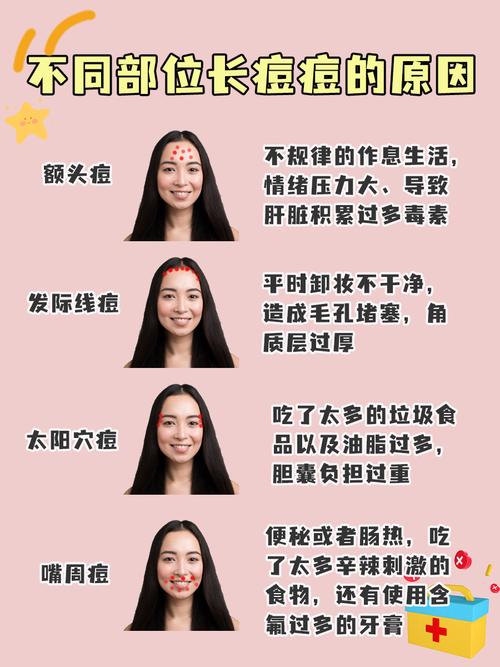 眉头痘痘是什么原因