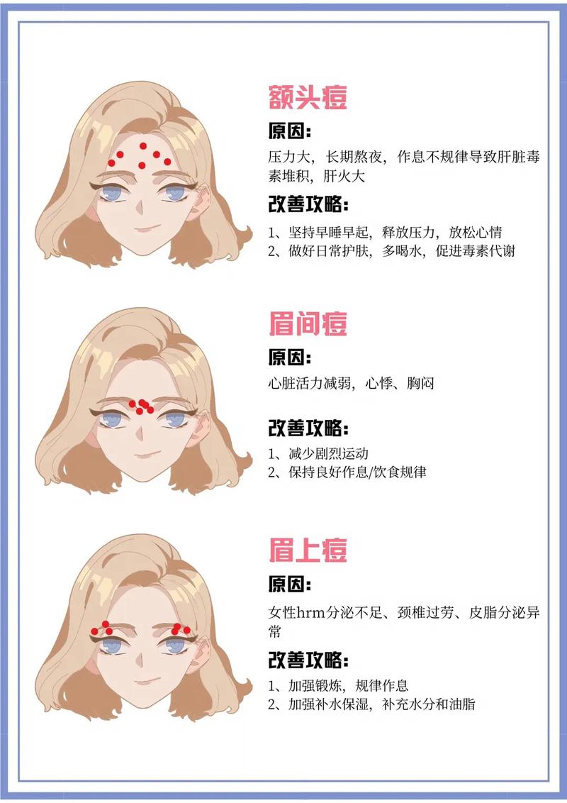 眉头痘痘是什么原因