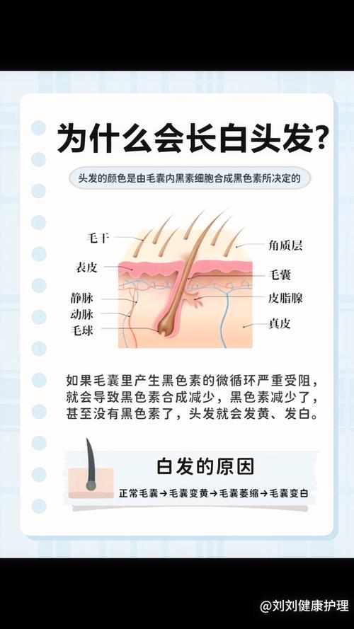 白头发多是为什么
