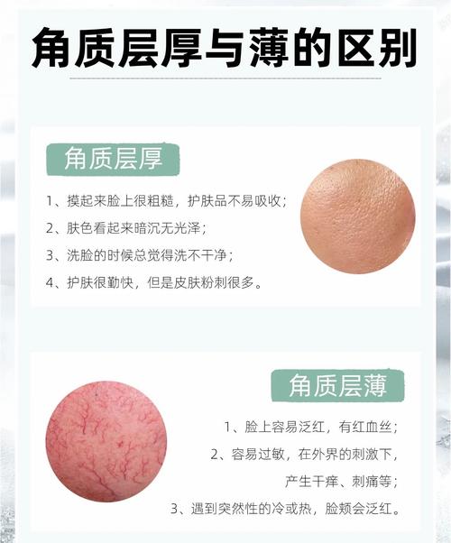 什么是角质层薄
