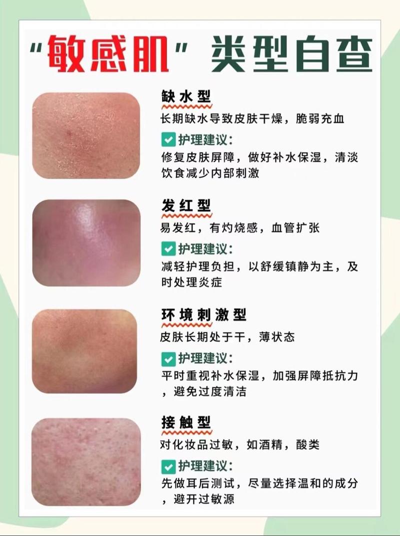面部脱皮是什么原因