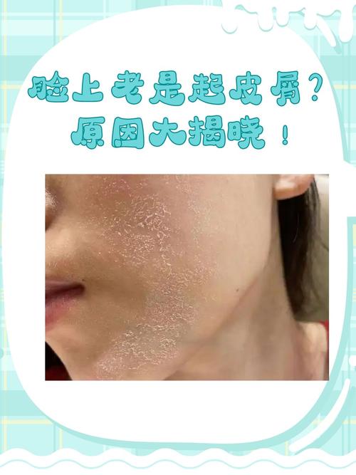 面部脱皮是什么原因