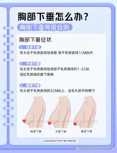乳房下垂是什么原因