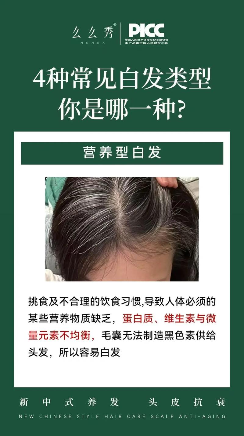 吃什么不会白头发
