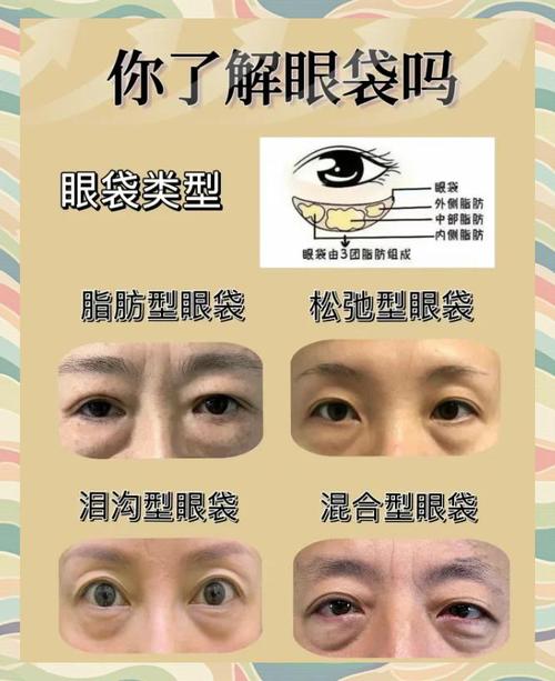 眼袋痛是什么原因