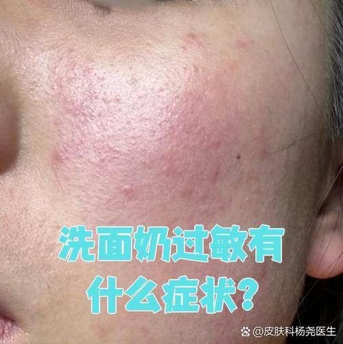 用洗面奶洗脸后脸有点粘怎么回事