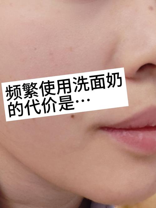用洗面奶洗脸后脸有点粘怎么回事
