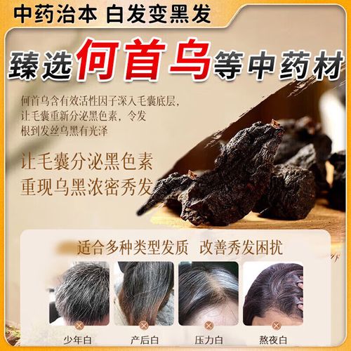 脱发吃什么中药调理