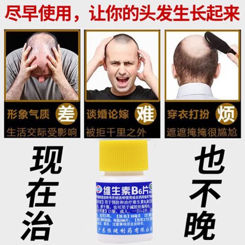 脱发吃什么中药调理