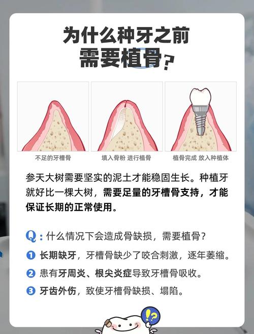 植骨是什么