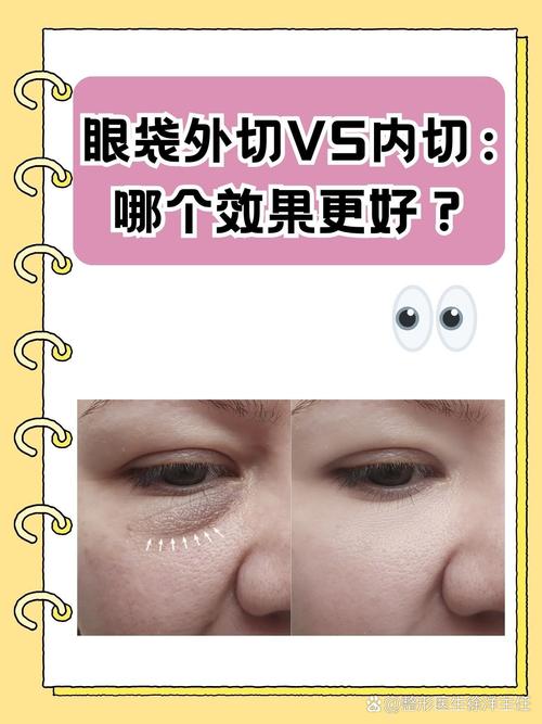 什么是内切