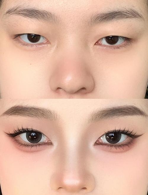 肿眼泡什么意思