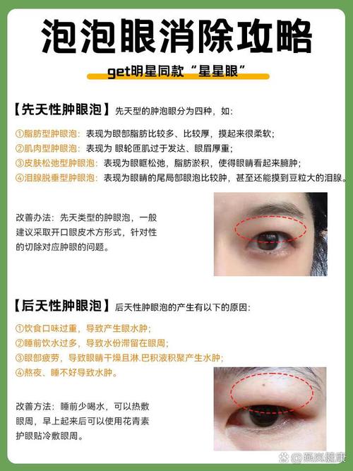肿眼泡什么意思