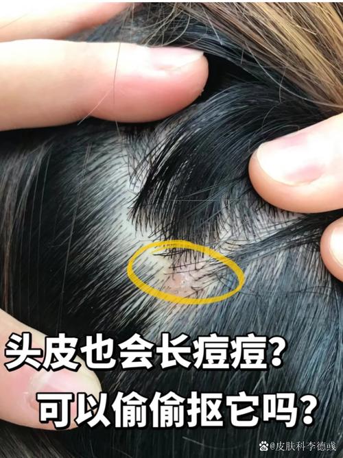 头上起疙瘩是什么原因