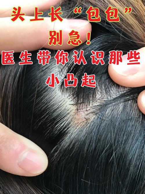 头上起疙瘩是什么原因